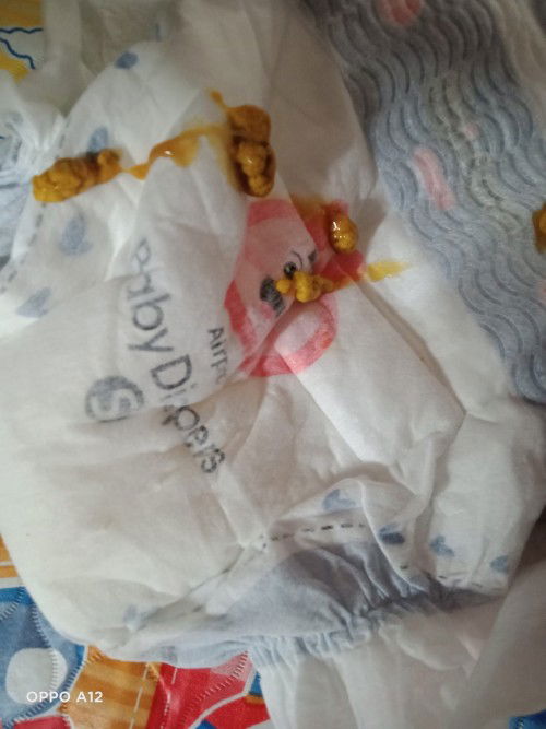 Normal lang po ba yung ganitong poop ni baby na parang may sipon?