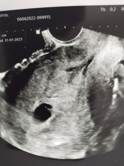 1เดือนครึ่งเท่ากับ 6สัปดาห์ ไหมค่ะ