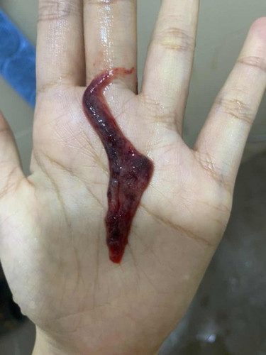 Keguguran atau bukan?