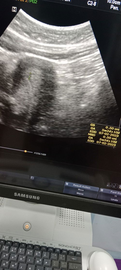 Tolong jwp yg pernah alami