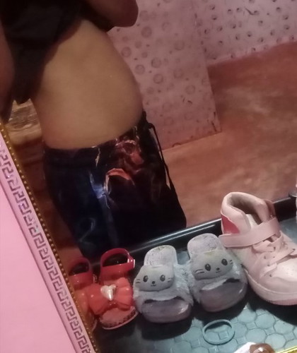 Buntis ba?