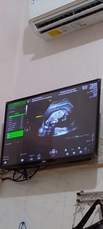 Janin 4 bulan lebih 2 hari ♡