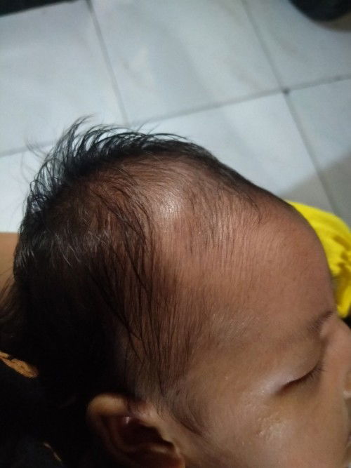 Kepala bayi
