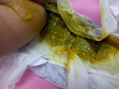 Popo po ni baby normal po ba??