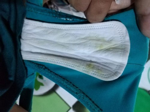 Yellow Green Discharge!No odor