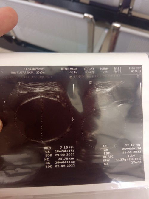 Usia kandungan 27 minggu