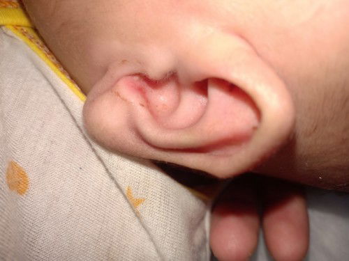 Telinga bayi bau dan berdarah di garuk