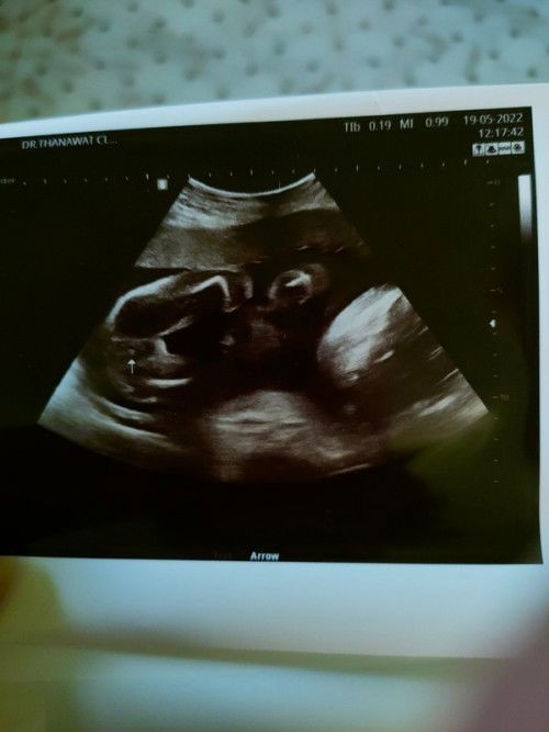 ฝากครรภ์โรงพยาบาล