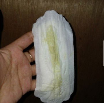 Keputihan hijau ke Kuningan bahaya atau tidak ?