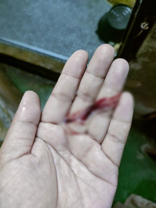 38วีค มีมูกเลือด แต่ปากมดลูกไม่เปิด