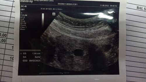 Edd scan & last period berbeza..