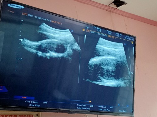 Transabdominal