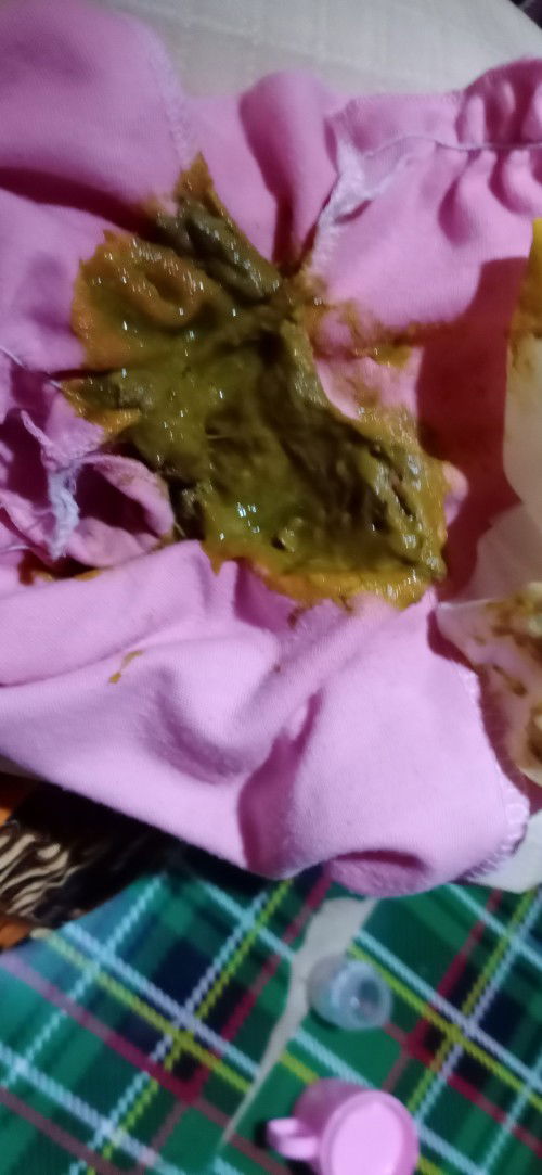 Pup bayi masih encer