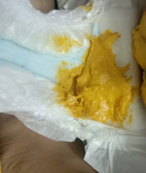 Normal ke najis ni ?