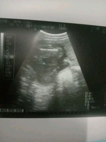 แบบนี้ผ.ชหรือผ.ญคะ