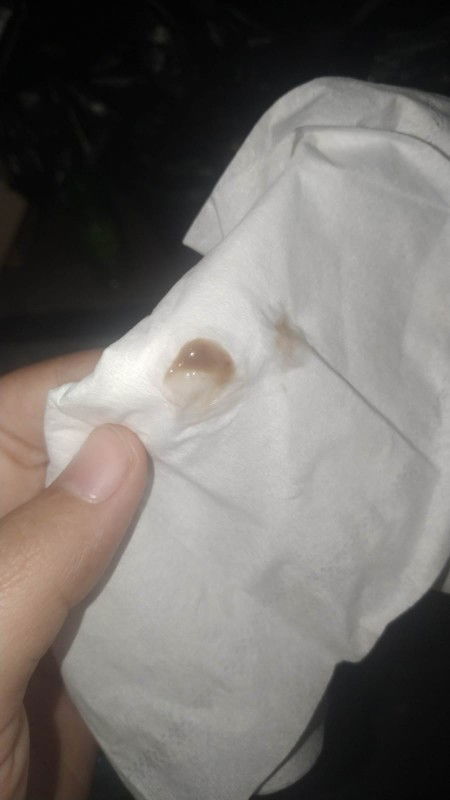 Hamil 5 week 6 hari ngeflek coklat