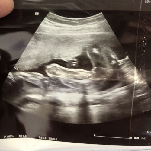 น้องผู้หญิงหรือผู้ชาย