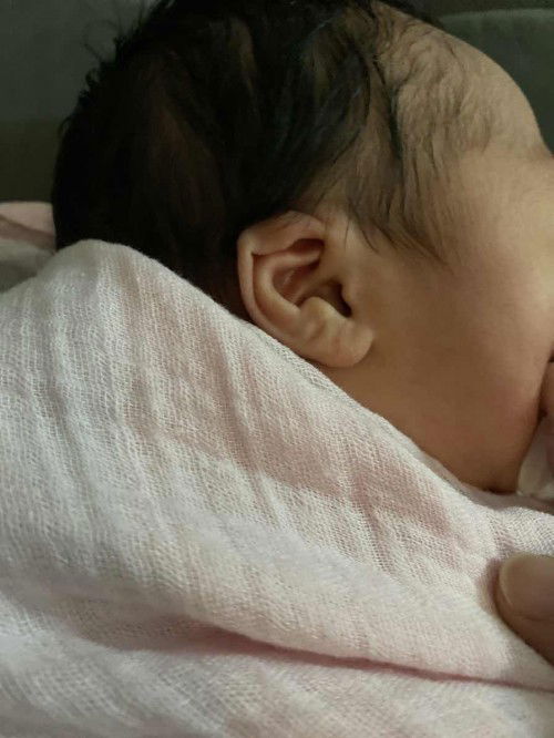 Baby’s earlobes curled up