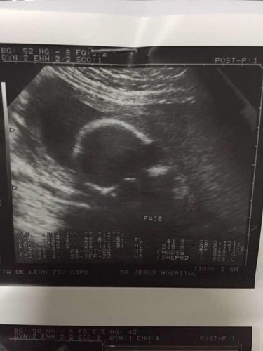 Nose po ba yon ni baby?