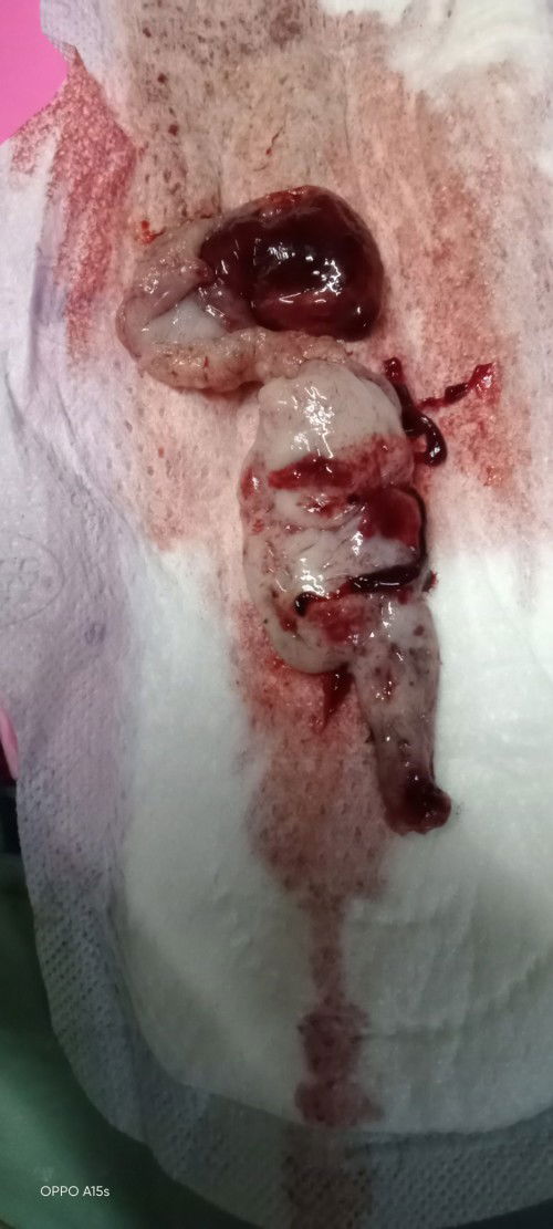 Ano po kya ung lumbas sa pwerta q po nba2hla po kc aq now lng po nangyri skn 2..