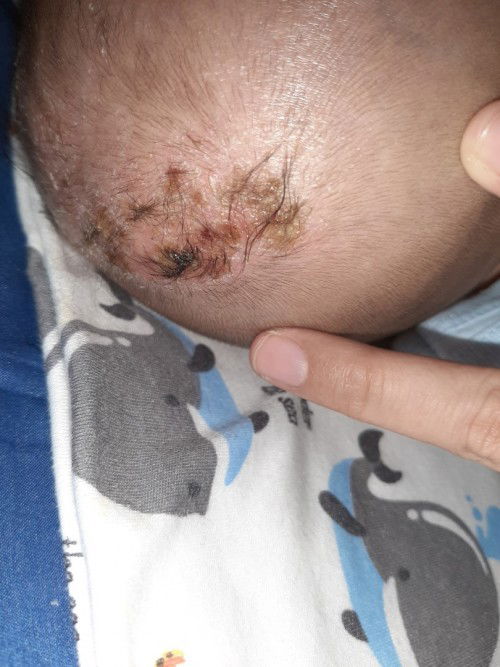 Kepala anak berkerak