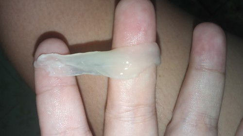 สอบถามค่ะ ตั้งครรภ์ได้36สัปดาห์แล้วตกขาวแบบนี้คือปกติไหมคะเดือนนี้เป็น2ครั้งแล้ว
#ท้อง3