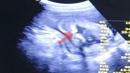 ดูเพศให้หน่อยค่ะ