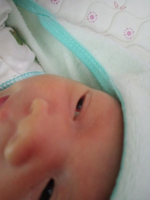 ตาน้องเป็นอะไรค่ะ