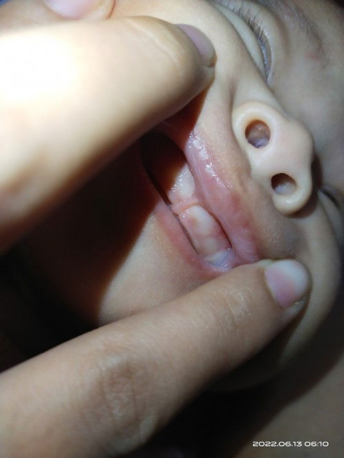 LIP TIE po ba si baby ? 
salamat po sa sasagot