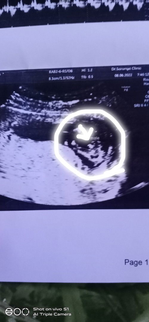 ขอสอบถามค่ะ