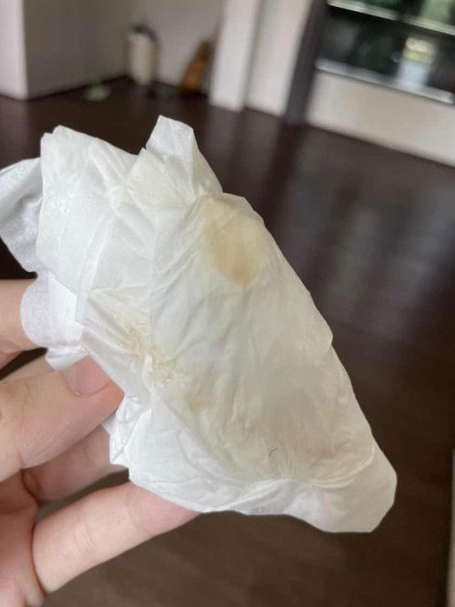 ท้อง 14 สัปดาห์ 4 วัน มีอาการปวดขาหนีบ และ ตกขาวมีสี