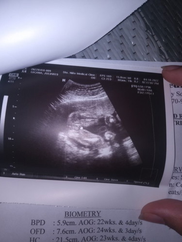 Girl or boy?