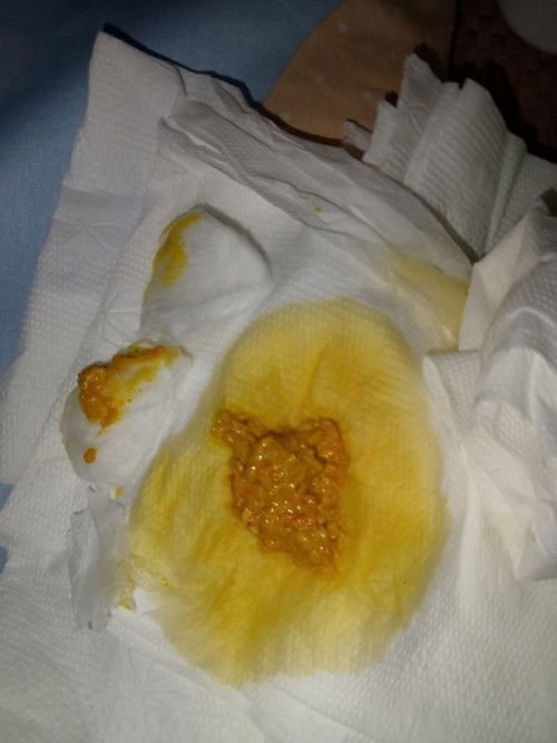 แบบนี้ปกติไหมคะ