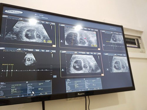 แม่ๆเห็นอะไรที่ผิดสังเกตุกันมั้ยคะ