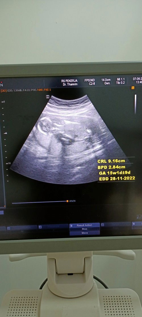 16w sudah ada gerakan cinta belum bun ??