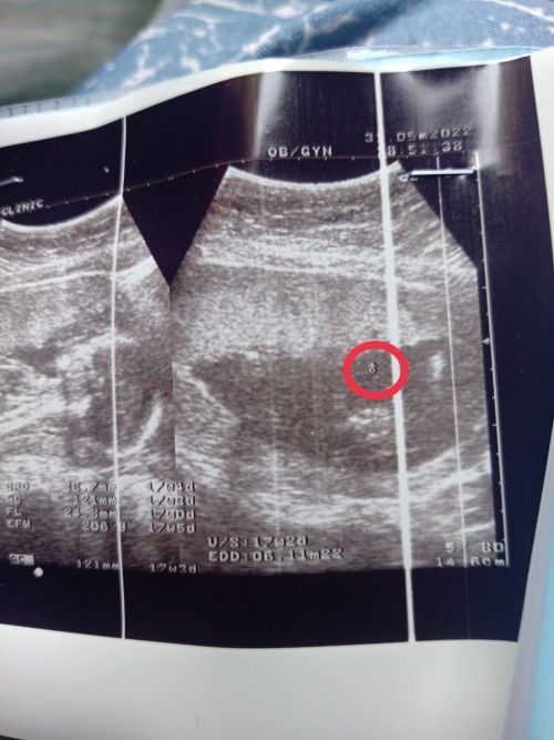 สอบถามหน่อยค่า