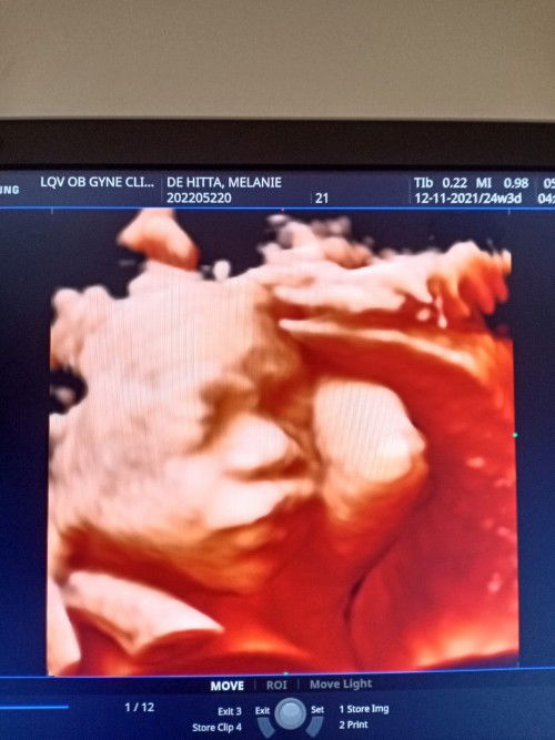 CAS ULTRA with 3D freebie 😁