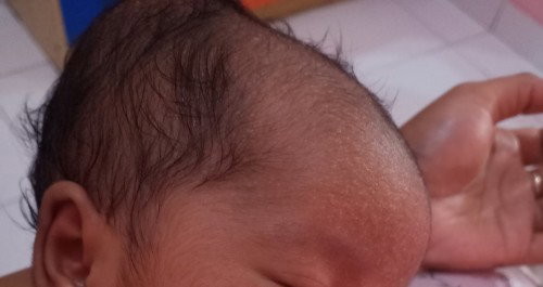 Seputaran bunda bunda