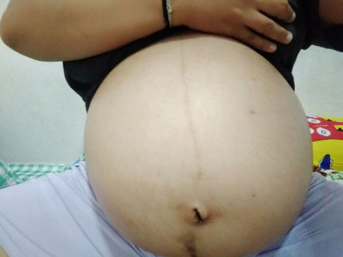 ขอดูท้องแม่ๆ32วีคหน่อยคะ