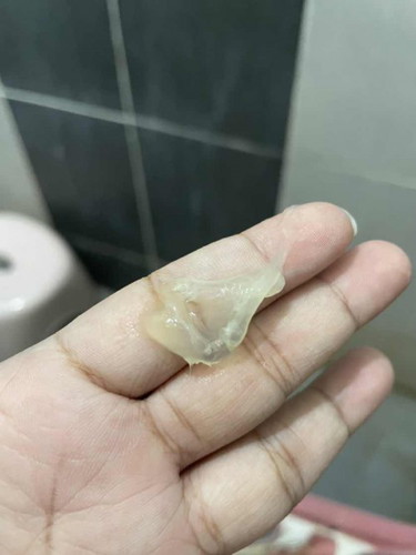 มูกใสออกจากช่องคลอด 36w