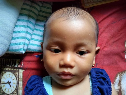 Bintik putih2 dipipi