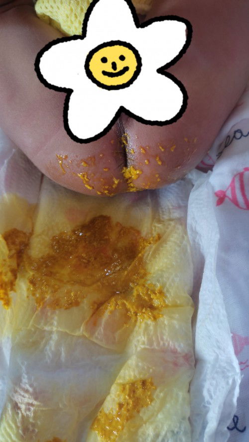 สอบถามแม่ๆ หน่อยค่ะ