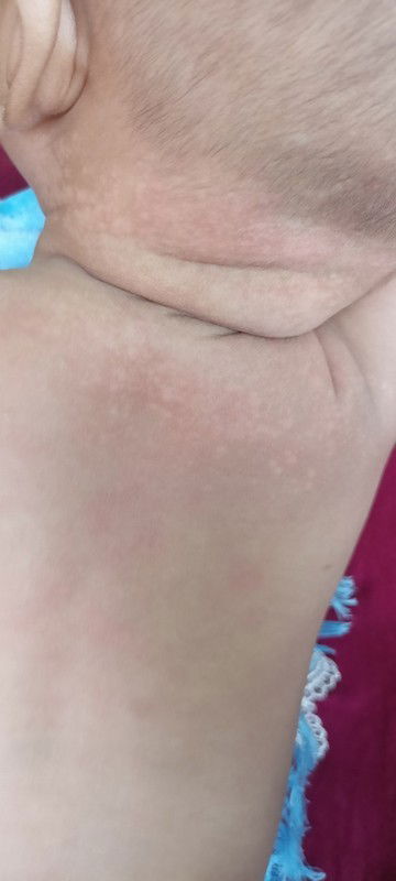 Kulit bayi berwarna putih