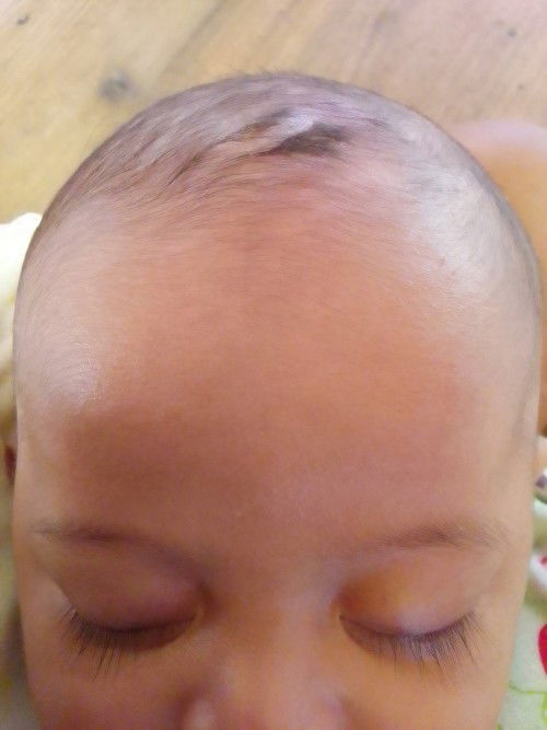 Ubun ubun kepala bayi