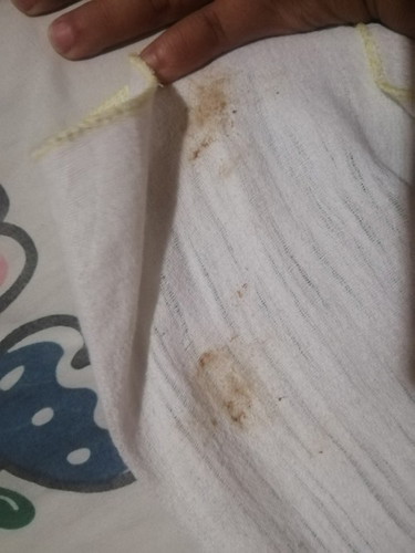 Mga bahid..sino po nakaranas?