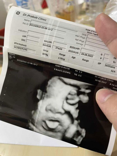 เบบี้ตัวใหญ่เกินเกณฑ์