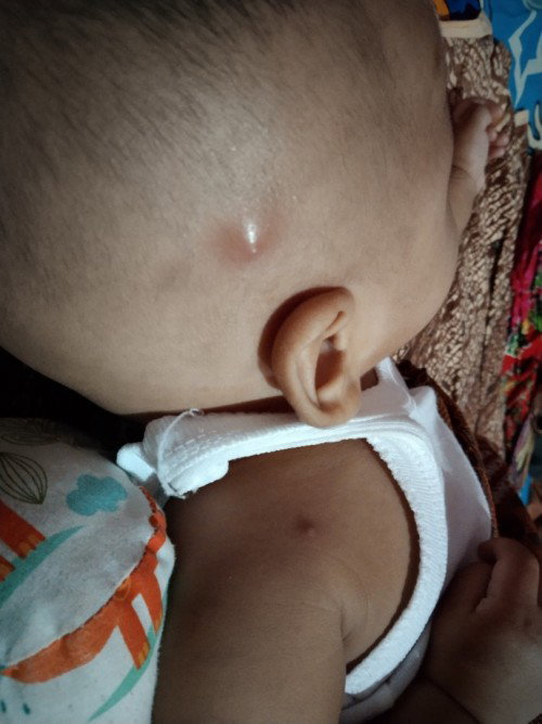 Seputar bayi