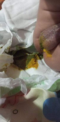 Mga kamommy pahelp naman po.Yung Lo ko kasi going 3 months Nestogen 1 gatas niya.