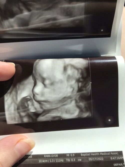 Anyone due in October?