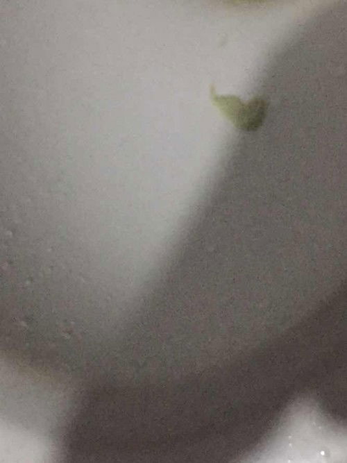 Ano po kaya itong lumabas na discharge saken? Kasama po sya ng ihi